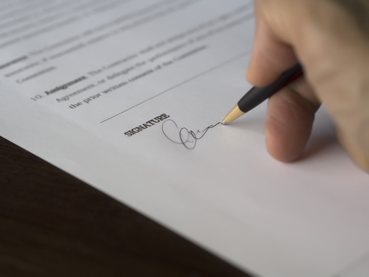 The 360 deal: Is it worth it?