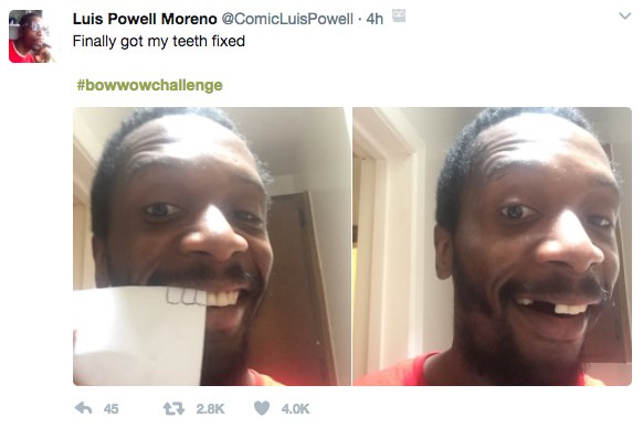 Finally Got My Teeth Fixed! The Bow Wow Challenge