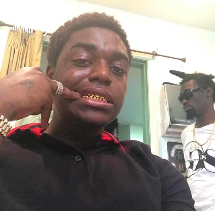 Kodak Black Surgically Removes His Gold Teeth Smile.