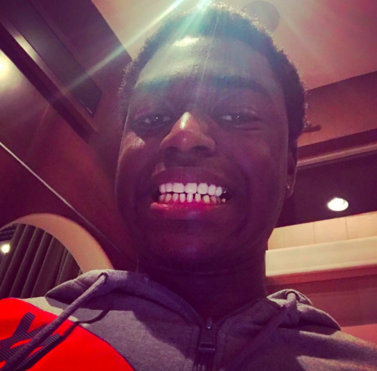 Kodak Black Surgically Removes His Gold Teeth (Smile!)