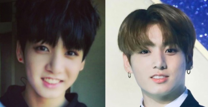 Is BTS Addicted to Plastic Surgery? We Asked a Plastic Surgeon