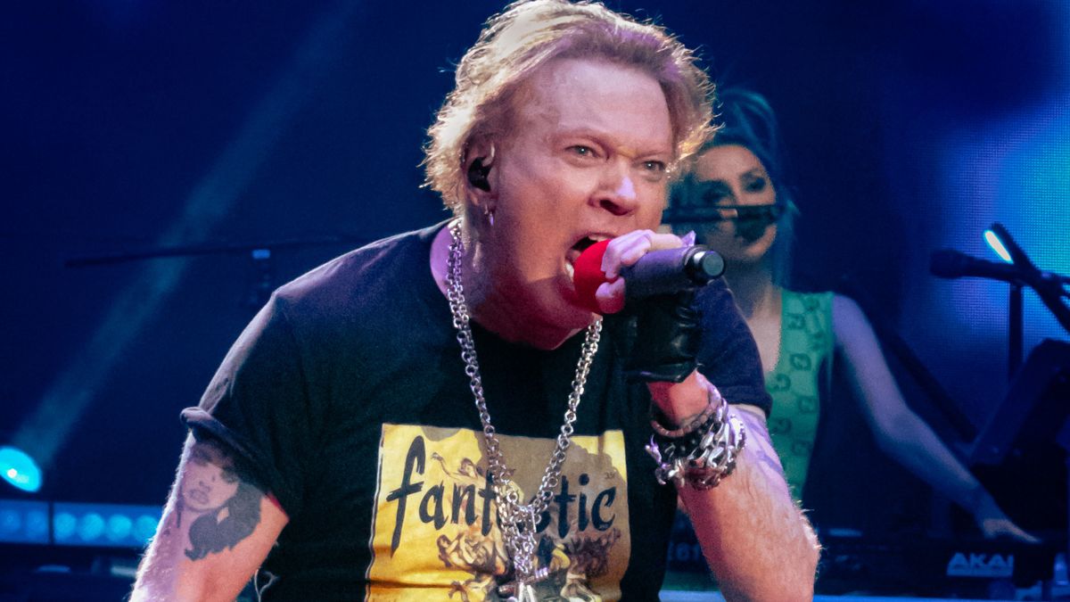 Axl Rose Won’t Throw Mics into the Crowd Anymore After Injury